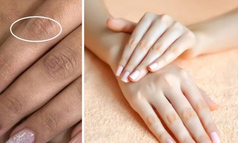 تجربتي مع كريم طبي لتفتيح مفاصل اليدين وطريقة الاستخدام الصحيحة تجربتي مع كريم طبي لتفتيح مفاصل اليدين وطريقة الاستخدام الصحيحة