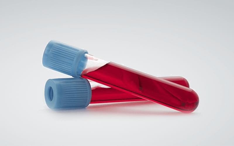 ما هو تحليل الدم tp وما وأهم وظائفه