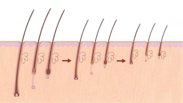 تفسير شعر الجسم في المنام لابن سيرين