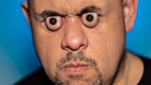 تيك توكر يدخل موسوعة جينيس بسبب حجم عينه.. ما القصة؟ تيك توكر يدخل موسوعة جينيس بسبب حجم عينه.. ما القصة؟