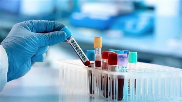 أطباء بريطانيا: اختبار دم جديد للكشف عن 12 نوعًا من السرطان بدقة تصل إلى 99% أطباء بريطانيا: اختبار دم جديد للكشف عن 12 نوعًا من السرطان بدقة تصل إلى 99%
