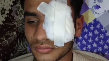 ضربه بالبوكس بسبب الستات.. شاب يفقأ عين آخر إثر مشاجرة في طنطا