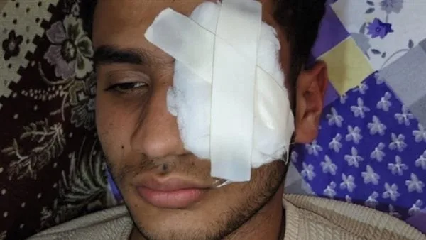 ضربه بالبوكس بسبب الستات.. شاب يفقأ عين آخر إثر مشاجرة في طنطا ضربه بالبوكس بسبب الستات.. شاب يفقأ عين آخر إثر مشاجرة في طنطا