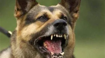 كلب يعقر طفلة داخل كمبوند شهير في الشيخ زايد