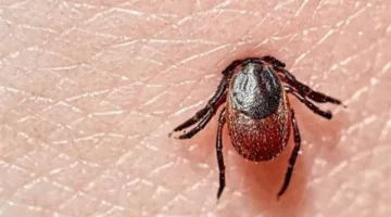 أبرزها الطفح الجلدي.. دراسة تكشف عن أعراض مرض لايم