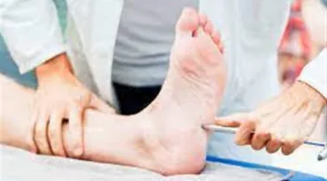 يؤثر على الذراعين والقدمين.. ما هو اعتلال الأعصاب؟