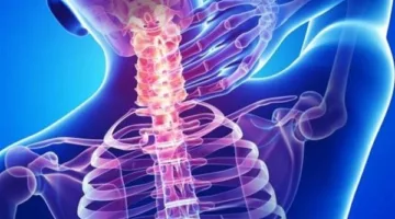 أبرزها حوادث السيارات.. أسباب قطع الحبل الشوكي