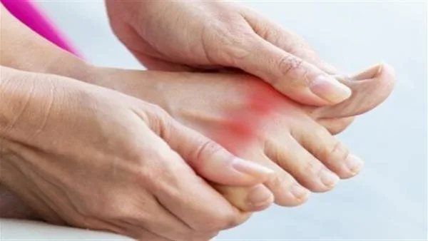أطعمة تساعد على علاج وتخفيف أعراض النقرس