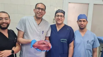 استئصال طحال متضخم يزن 2 كيلو من مريضة بمستشفى أسيوط العام