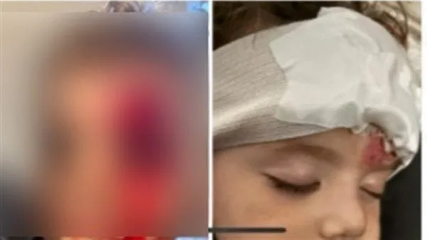 بعد الموافقة على لائحة القانون الجديد.. سيدة تستغيث بعد تعرض صغيرها لتشوه بسبب كلب في القاهرة الجديدة بعد الموافقة على لائحة القانون الجديد.. سيدة تستغيث بعد تعرض صغيرها لتشوه بسبب كلب في القاهرة الجديدة