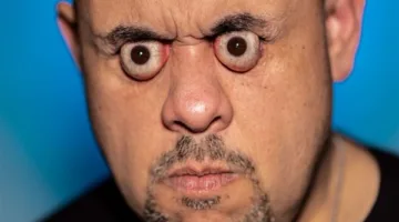 تيك توكر يدخل موسوعة جينيس بسبب حجم عينه.. ما القصة؟