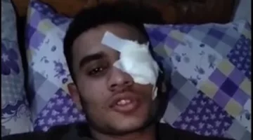 شاب يفقد عينه خلال دفاعه عن زميلات العمل بطنطا: عايز حقي| بث مباشر