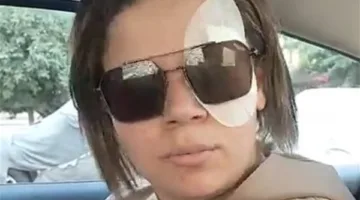 ضحية الصفع على يد زميلها في مطعم بمدينة نصر: ضربني عشان افتكر إني بتكلم عليه وحش | بث مباشر