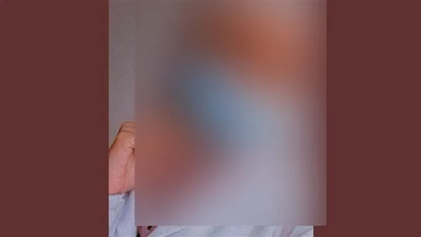 ممرضة تتعرض للاعتداء من أهلية مريضة بمستشفى خاص: ضربوني بكرسي متحرك وأهانوني في مكان عملي ممرضة تتعرض للاعتداء من أهلية مريضة بمستشفى خاص: ضربوني بكرسي متحرك وأهانوني في مكان عملي