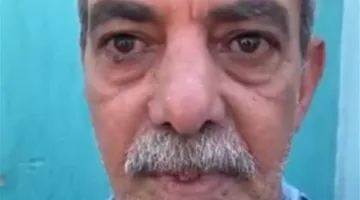 والد شاب دهسته سيارة مسرعة ببورسعيد: مافيش حتة في جسمه سليمة.. وعاوز حقه بالقانون| بث مباشر