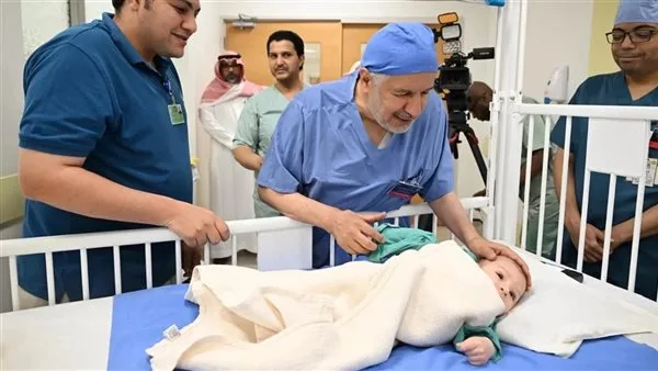 بتوجيهات ملك السعودية وولي عهده.. بدء عملية فصل توأم طفيلي مصري بمشاركة 26 استشاريا وأخصائيا