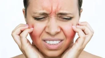 انتفاخ الوجه المستمر.. تعرف على أسبابه وطرق العلاج