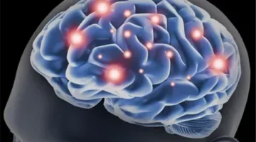 يؤثر على الأطراف والدماغ.. خبراء يحذرون من مرض الاضطراب العصبي الوظيفي