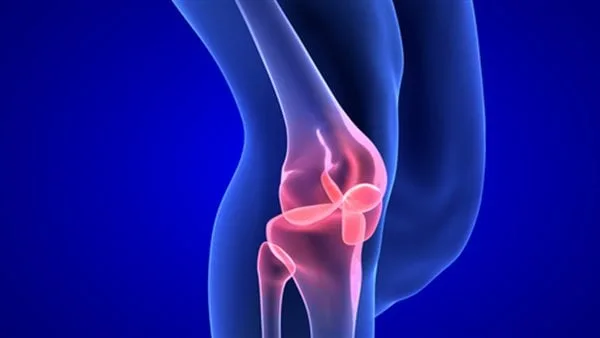 أبرزها هشاشة العظام… أسباب كسور مفصل الركبة