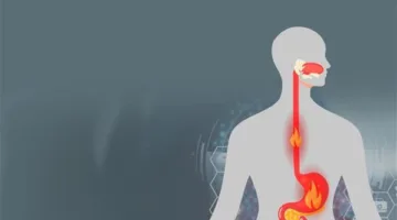 أبزرها تناول الأطعمة الغنية بالألياف.. طرق لتقليل أعراض ارتجاع المريء