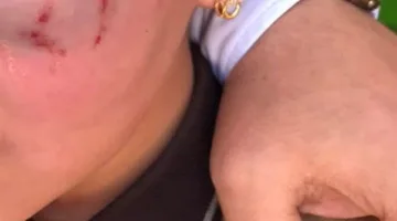 استبعاد معلم بعد اعتدائه على تلميذة داخل مدرسة في الدقهلية..وأول تعليق من والد الطفلة: "مش هسيب حقها"