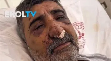 بسبب خلاف على الأجرة.. سائح بريطاني يعتدي على سائق تركي ويتسبب في دخوله العناية المركزة