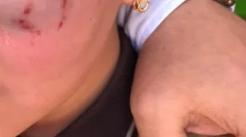 بعد موجة الغضب.. أسرة الطفلة المعتدى عليها داخل مدرسة تتصالح مع المعلم المعتدي: "الموضوع كان غير مقصود وبنناشد الناس تقفلوا"