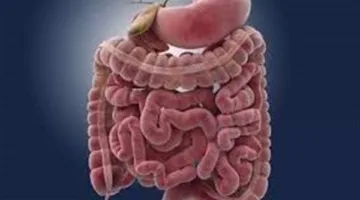 خبير بريطاني: فيتامين د قد يساعد في تقليل خطر الإصابة بسرطان الأمعاء