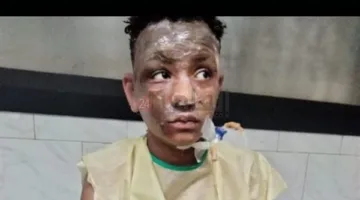 سيف ضحية انفجار الواحات أثناء ذهابه للعمل: كنت رايح الشغل.. وفجأة الدنيا ولعت