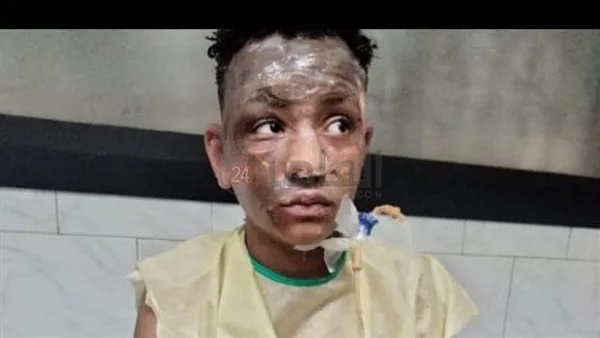 سيف ضحية انفجار الواحات أثناء ذهابه للعمل: كنت رايح الشغل.. وفجأة الدنيا ولعت