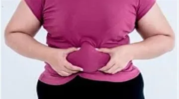 علاج السمنة في البيت.. طبيب يقدم روشتة تساعد على خسارة الوزن