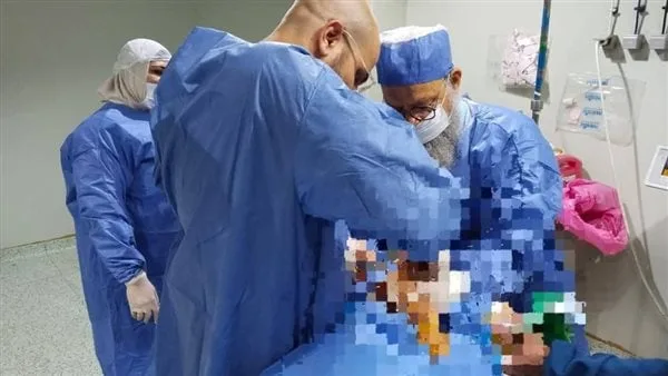 كيس بين المثانة.. نجاح جراحة معقدة لمريض في مستشفى أسيوط الجامعي